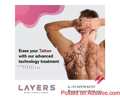 Best Skin Tattoo Removal Treatment In Hyderabad - Layers Clinics