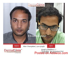 Get Best Hair fall Treatment from DermaClinix