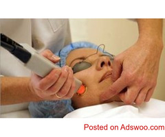 Acne Scar Cost in Delhi