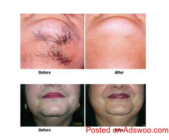 Dr Me Ping Gel Permanent Hair Removal Cream for Upper Lip and Chin