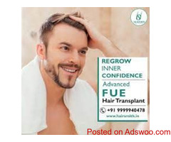 Best Hair Transplant Surgeon in Delhi