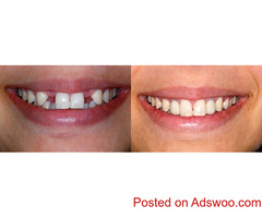 Restore smile with Bayswater Dentist