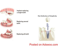 Restore smile with Bayswater Dentist
