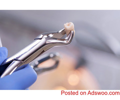 Get relief from painful Wisdom Teeth- Bayswater Dentist