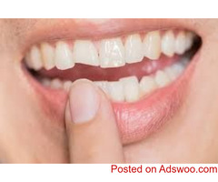 Find The Top-Rated Dentist in Langley