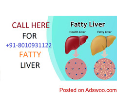 9355665333):-Fatty liver treatment in Bahadurgarh