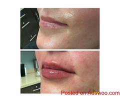 botox treatment louisville ky Call Us: (502) 974 3447