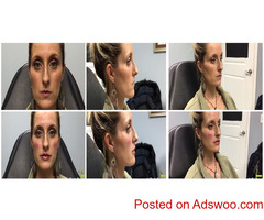 botox treatment louisville ky Call Us: (502) 974 3447