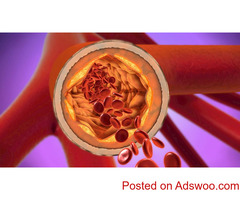 High Cholesterol Treatment | Lipid Treatment