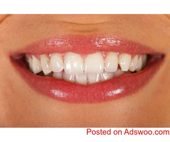 Make your Smile Flawless- Bayswater Scale & Clean