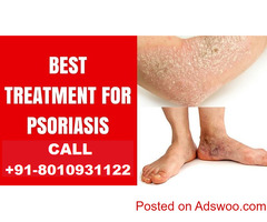 9355665333)-Treatment for gestational diabetes in Rohini