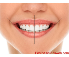 Now Smile with Confidence- Smile Design Bayswater