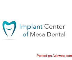 Dental Implants San Diego Cost - Implant Center of Mesa Dental