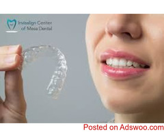 Best Price For Invisalign - Invisalign Center of Mesa Dental