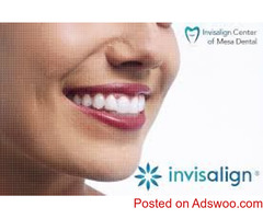 Best Price For Invisalign - Invisalign Center of Mesa Dental