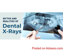 Myths and Realities of Dental X-Rays | Dental Blogs