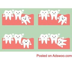 What Are Wisdom Tooth Impactions and Its Different Types
