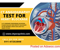 CT Coronary Angiography Scan Near Me At Best Price