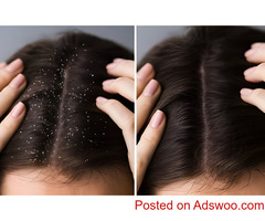 Hair Dandruff Treatment