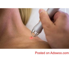 Revitalize Your Skin with Professional Mole and Skin Tag Removal