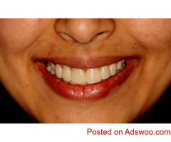 Clarity Dental - Expert Invisalign in Winnipeg