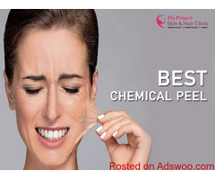Discover Radiant Skin with Best Chemical Peel Treatments in Bangalore