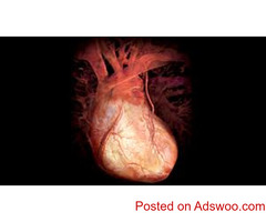 Heart Surgeon in Jaipur