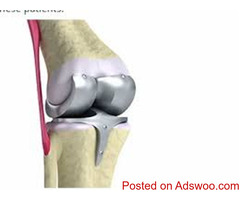 Knee Replacement Surgeon in Jagatpura, Jaipur