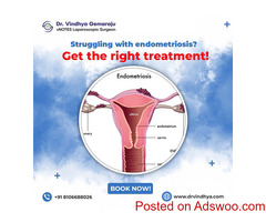 Best Endometriosis Treatment In Hyderabad