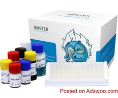 Boster Biological Technology Custom Antibody Production Services