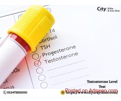 Testosterone Level Test Price Clear Cost Info Today