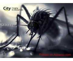 Malaria Symptoms and Blood Test Name You Should Know