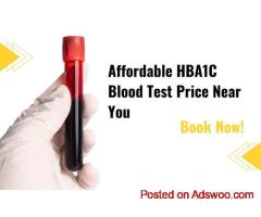HbA1c Blood Test: Purpose, Normal Range