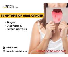 Symptoms of Oral Cancer: Stages, Diagnosis & Screening Tests