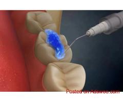 Dental Clinic | Dentist | Bangalore | Indiranagar | Best Dental Care