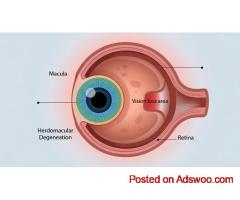 Retinitis Pigmentosa Treatment Near Me