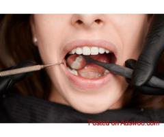 Get Tooth-Colored Fillings for a Perfect Smile in the USA
