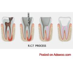 Save Your Tooth – Advanced Root Canal Treatment in Noida