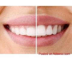 Laser Gum Disease Treatment Colorado Dental Wellness Center