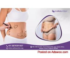 Advanced Liposuction in Surat | Callisto Clinic Specialists