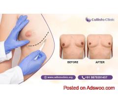 Callisto Clinic Trusted Male Breast Reduction Expert