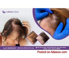 Advanced Hair Transplant in Surat – Callisto Clinic