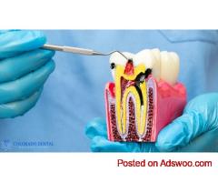 Gentle Laser Root Canals for Faster, Comfortable Relief
