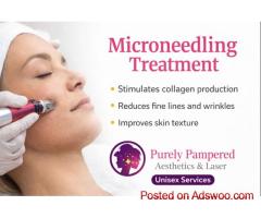 Microneedling Treatments Surrey BC – Book Now