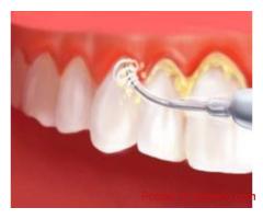 Cusp Dental & Maxillofacial Centre – Gurugram