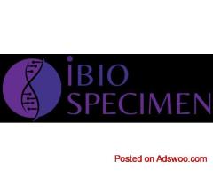 whole blood samples