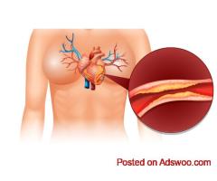 CT Coronary Angiography Pricing Explained with Benefits Overview