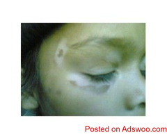 AROGYAM PURE HERBS KIT FOR VITILIGO