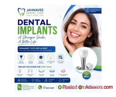 Dental Implants in Ahmedabad - Jahnavee Dental care