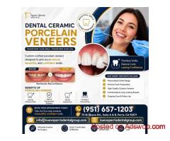 Dental Ceramic Porcelain Veneers California - Dr. Tejas Modi